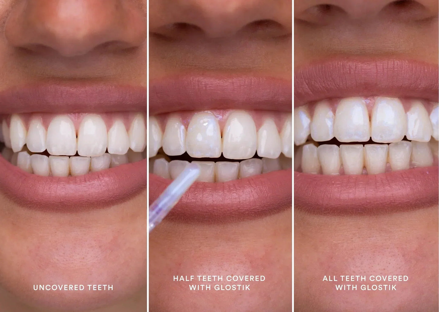 Brillo Dental Glossik